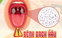 Bệnh Bạch hầu